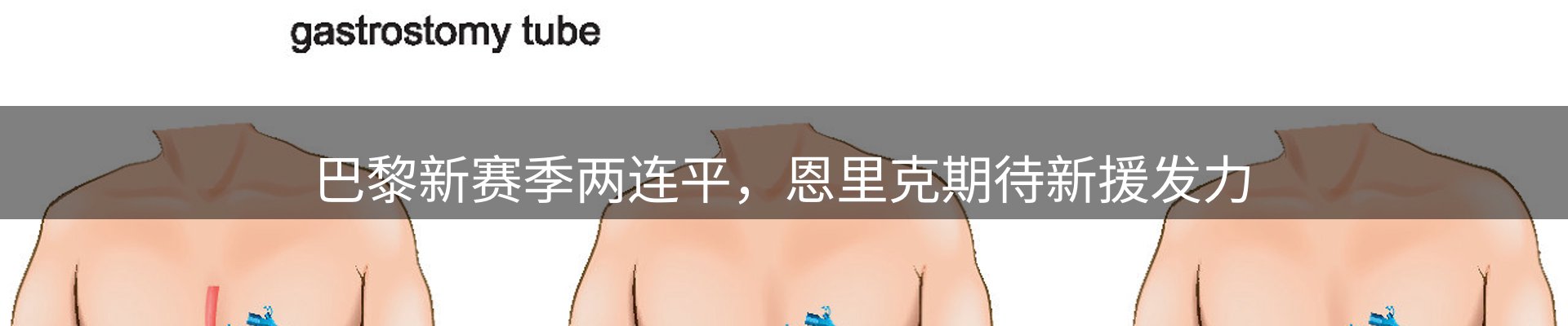 新闻汇集